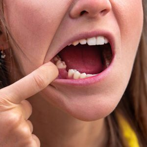 tooth extractions oral surgery near me